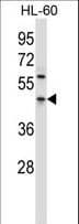 PDCD4 Antibody (aa121-149)