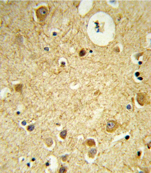 Polyclonal Rabbit anti-Human RECK Antibody (aa430-456, IHC, WB)