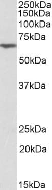 IHC-plus™ ANTXR2 / CMG2 Antibody (aa121-133)