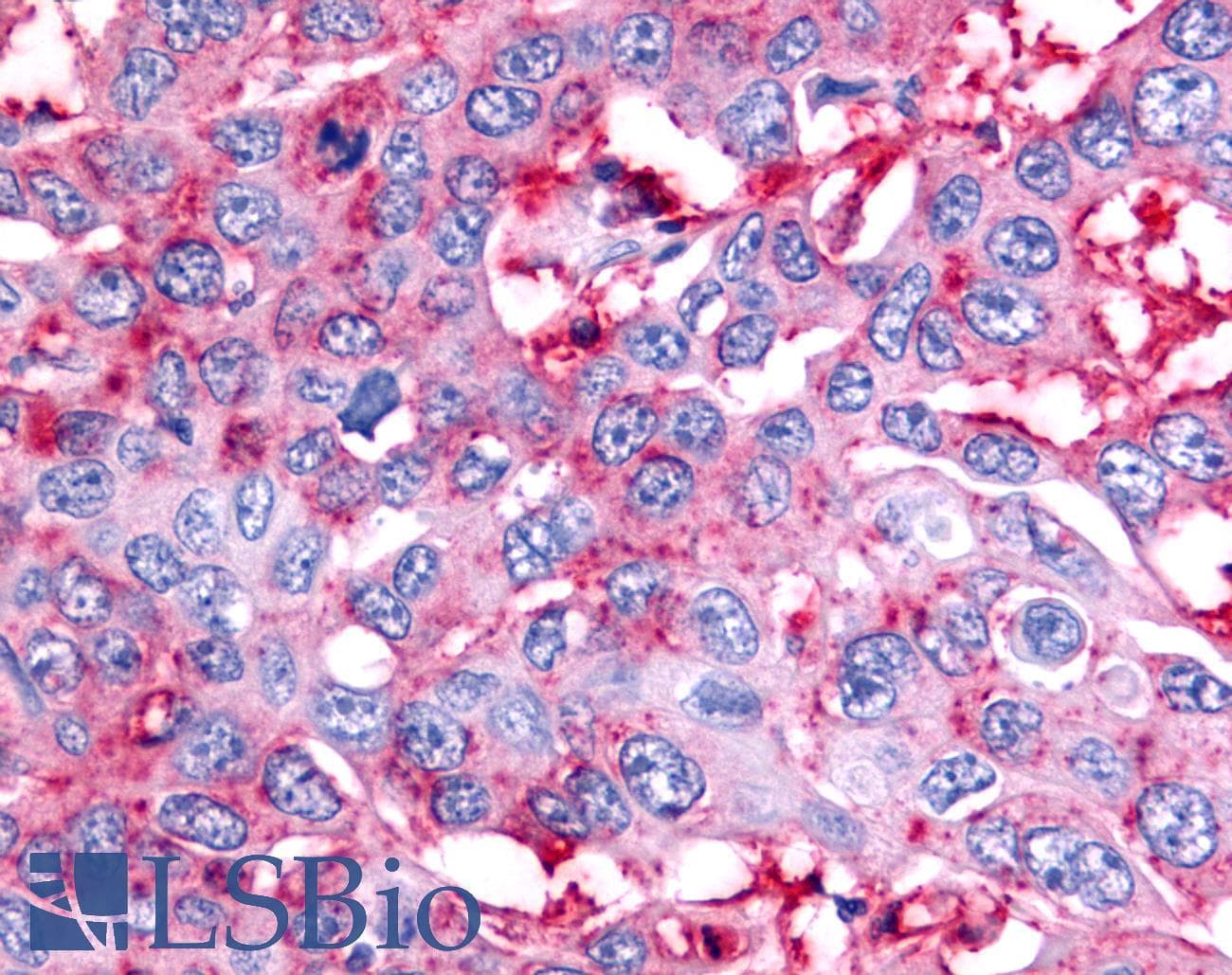 PathPlus™ NR5A2 / LRH-1 Antibody (C-Terminus)