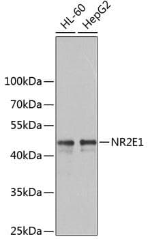 NR2E1 / TLX Antibody