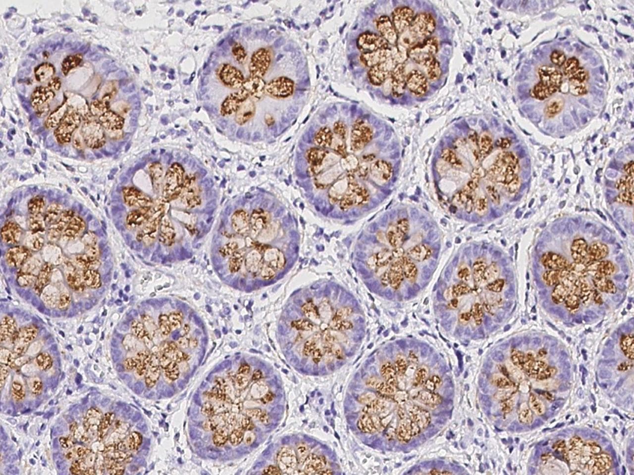 Polyclonal Rabbit anti-Human GOB5 / CLCA1 Antibody (IHC)