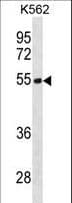 Polyclonal Rabbit anti-Human TES / Testin Antibody (aa41-70, WB)
