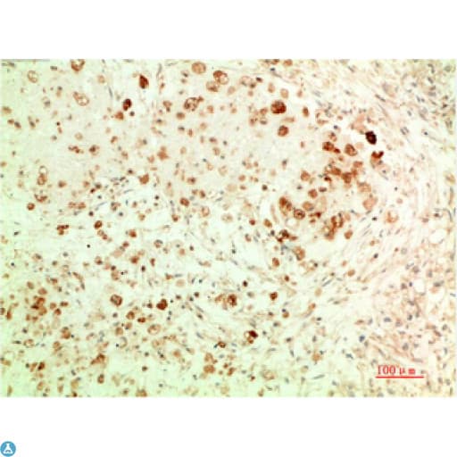 APG5 / ATG5 Antibody