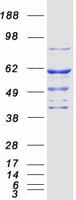 Human STK33 Protein (Recombinant Myc-DDK (Flag))