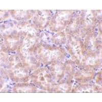 RIPK3 / RIP3 Antibody