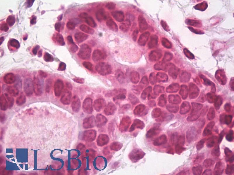 IHC-plus™ Polyclonal Rabbit anti-Human Histone H2A.X Antibody (C-Terminus, IHC, IF, WB)