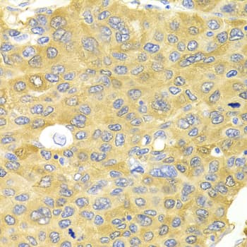 PA2G4 / EBP1 Antibody