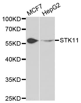 PathPlus™ STK11 / LKB1 Antibody