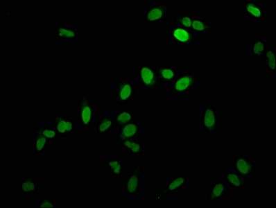 HIST1H1C Antibody