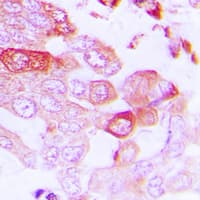 Polyclonal Rabbit anti-Human STEAP1 / STEAP Antibody (N-Terminus, IHC, WB)