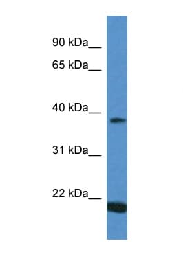 Polyclonal Rabbit anti-Human IFNA1 / Interferon Alpha 1 Antibody (C-Terminus, WB)