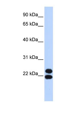 PRRX2 / PRX2 Antibody (aa35-84)