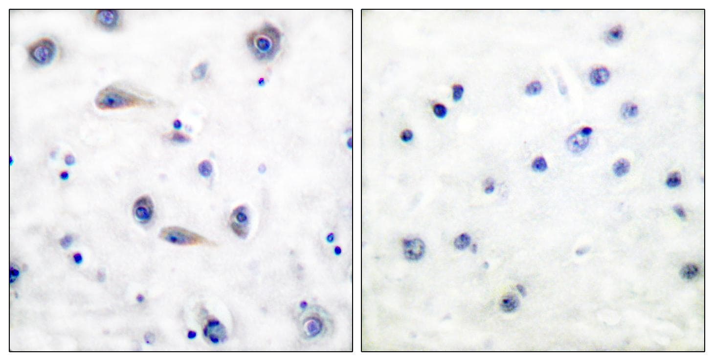 Polyclonal Rabbit anti-Human NTRK2 / TRKB Antibody (phospho-Tyr515, IHC, WB)
