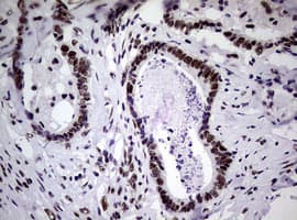 NBN / Nibrin Antibody (clone OTI6E11)