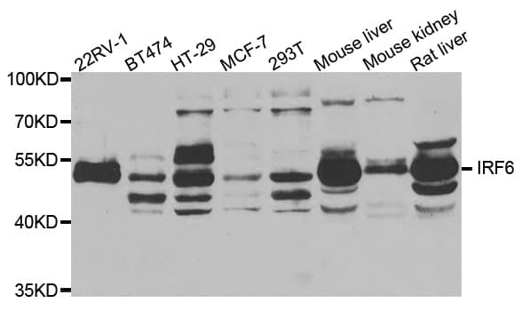 IRF6 Antibody