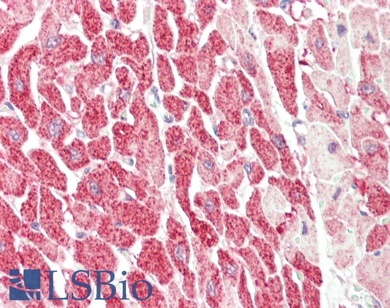 IHC-plus™ Polyclonal Rabbit anti-Human CENPU / MLF1IP Antibody (IHC, WB)