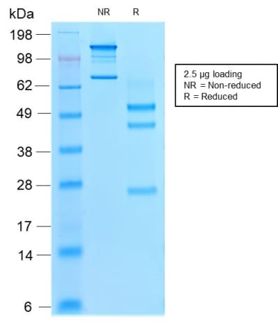 VIL1 / Villin Antibody (aa179-311, clone rVIL1/1325, Azide-free, Carrier-free)