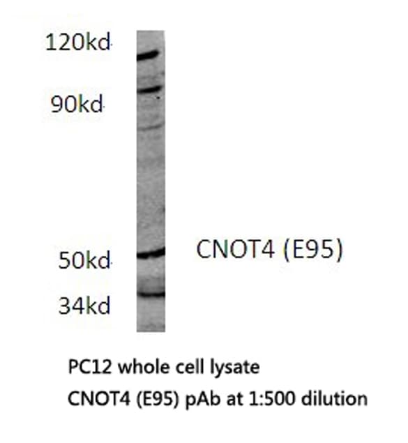 CNOT4 / CLONE243 Antibody (Glu95)