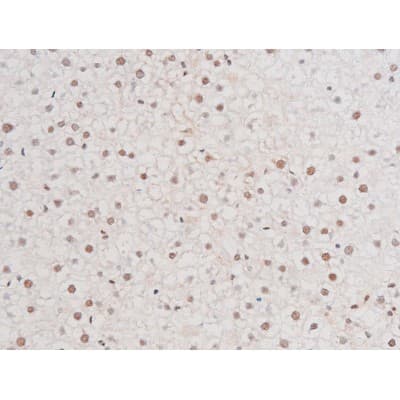 RELA / NFKB p65 Antibody (phospho-Ser281)