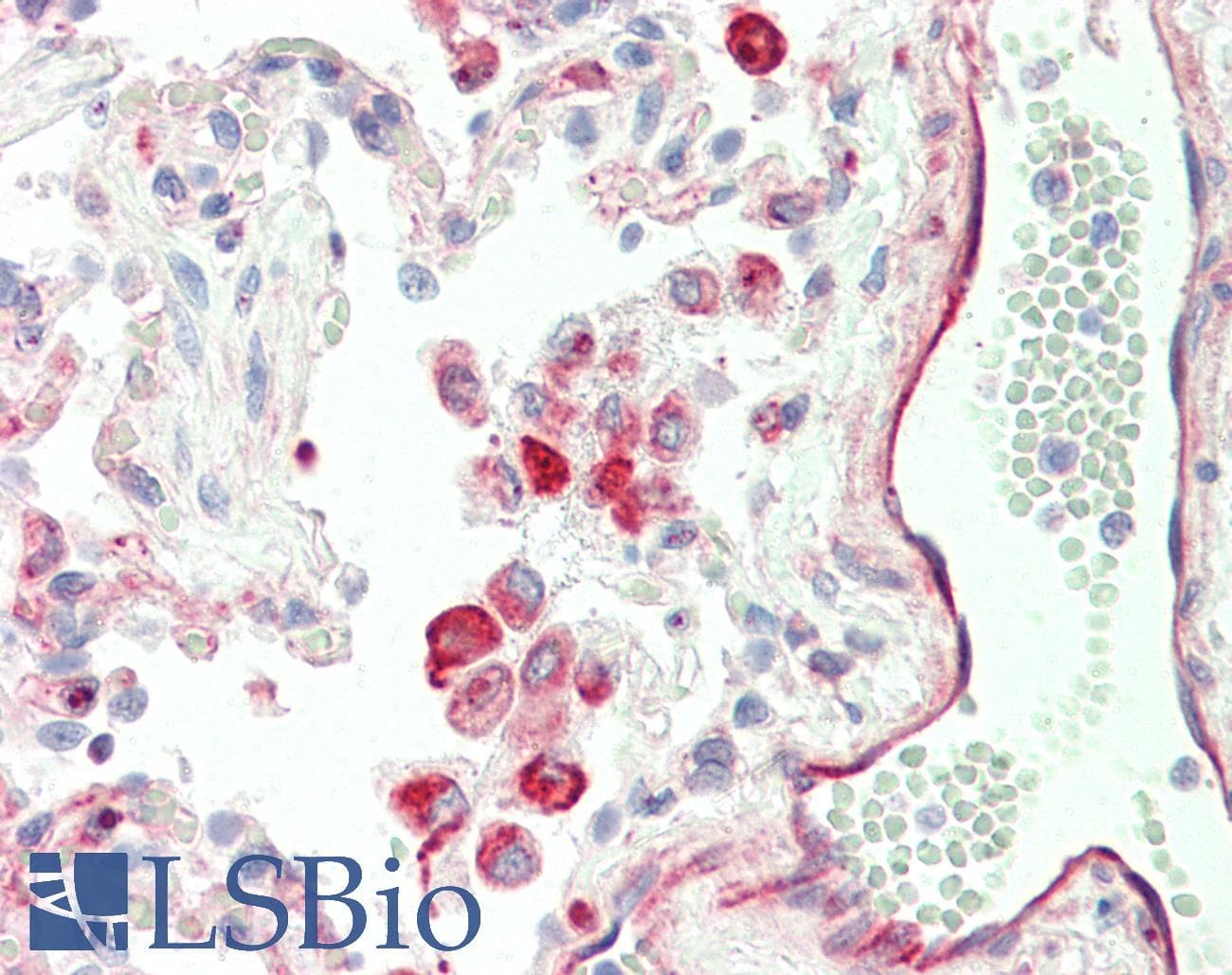 Polyclonal Rabbit anti-Human CA4 / Carbonic Anhydrase IV Antibody (C-Terminus, IHC, WB)