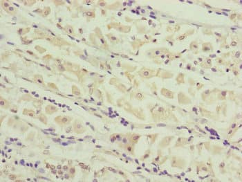 CEP44 / KIAA1712 Antibody