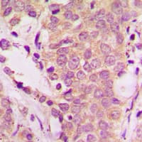 Polyclonal Rabbit anti-Human p66 / SHC Antibody (phospho-Tyr349, IHC, WB)