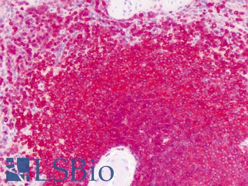 PathPlus™ GPRC6A Antibody (N-Terminus)