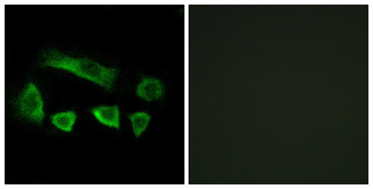 NT5C1B Antibody
