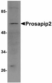 Polyclonal Rabbit anti-Human TBKBP1 Antibody (IHC, IF, WB)