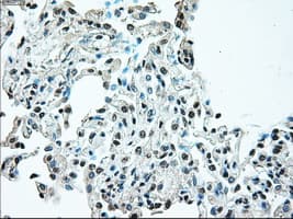 BRAF / B-Raf Antibody (clone OTI1G8)