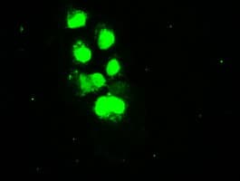 IHC-plus™ SSB / La Antibody (clone 1E11)