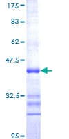 Human CNR1 / CB1 Protein (Recombinant GST, N-terminus)