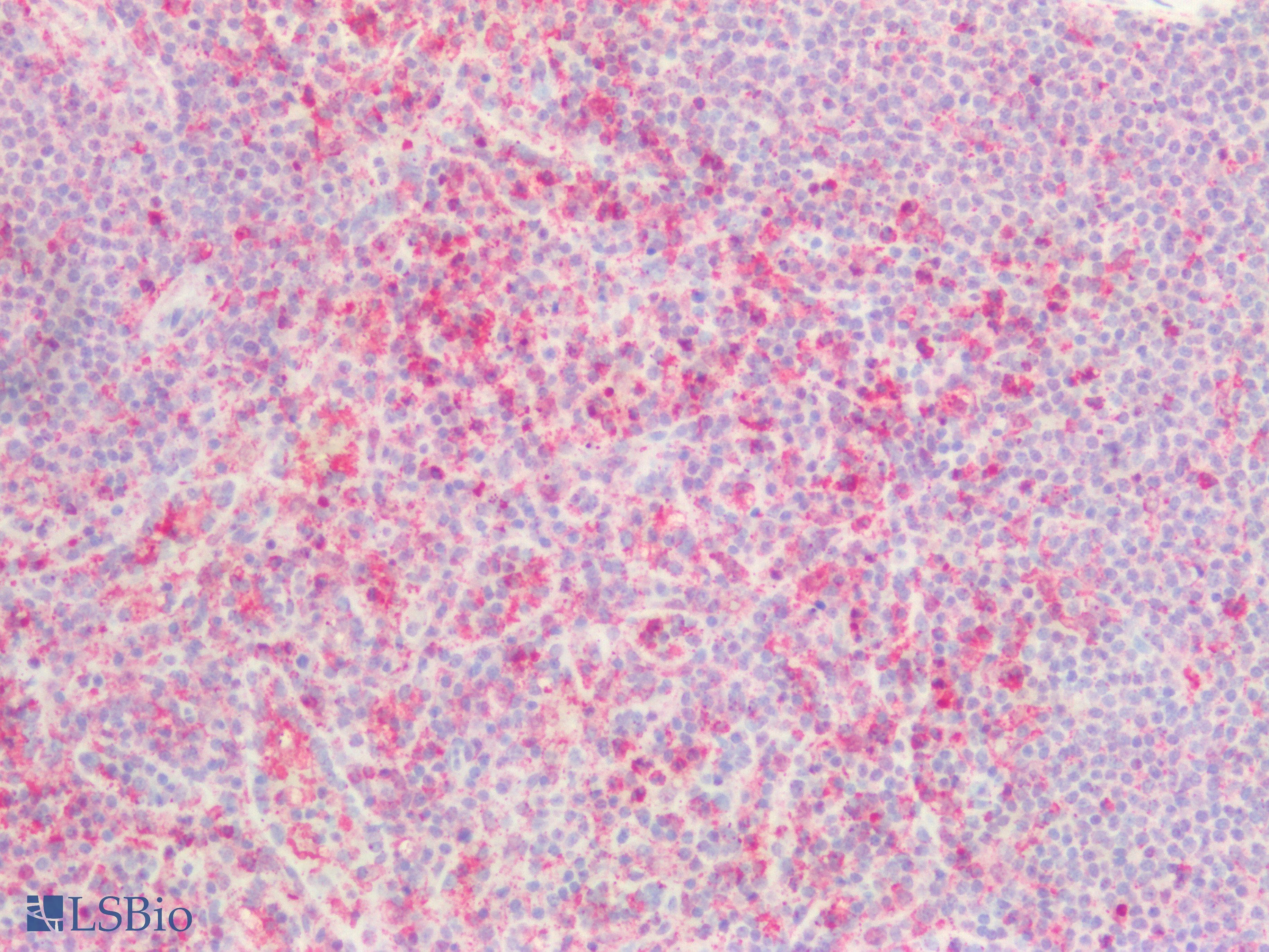 PathPlus™ GAS6 Antibody (aa483-646)