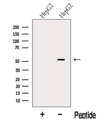 Polyclonal Rabbit anti-Human LACTB2 Antibody (WB)