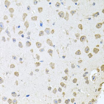 TARS Antibody