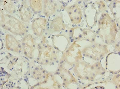 Polyclonal Rabbit anti-Human MRPS36 Antibody (IHC)