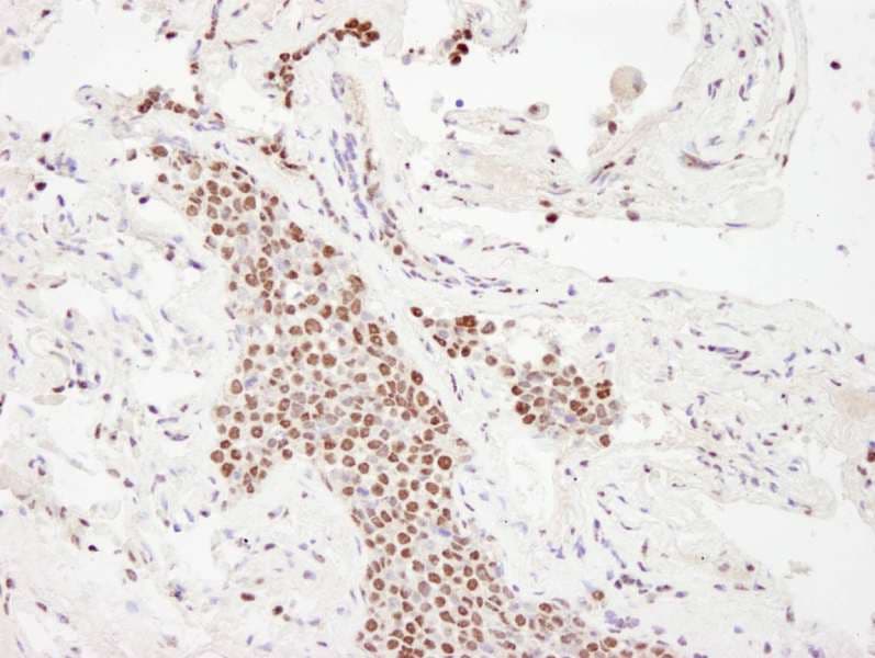 EP300 / p300 Antibody (aa950-1000)