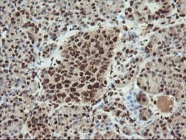 SAMHD1 Antibody (clone OTI1A1, Carrier-free)
