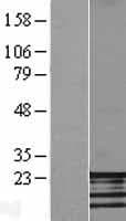 FATE1 Protein (Over-Expression Lysate Myc-DDK (Flag))