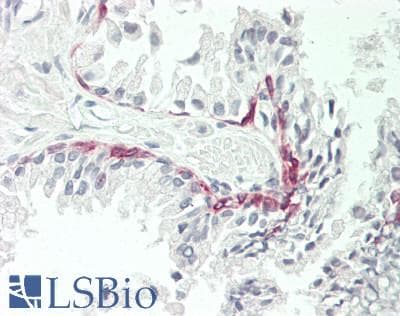 LAMC2 / Laminin Gamma 2 Antibody (aa416-602)