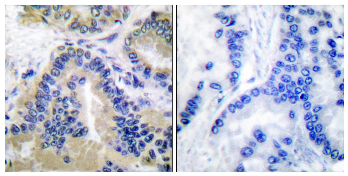 CASP10 / Caspase 10 Antibody (aa430-479)