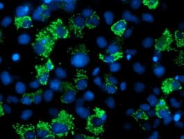 AK4 / Adenylate Kinase 4 Antibody (clone OTI2B12)