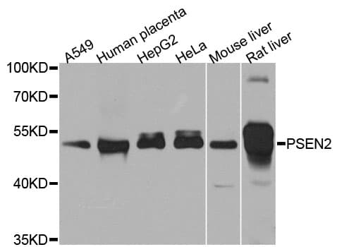 Polyclonal Rabbit anti-Human PSEN2 / Presenilin 2 Antibody (IHC, WB)