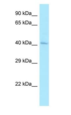 Polyclonal Rabbit anti-Human CLP1 Antibody (aa103-152, WB)