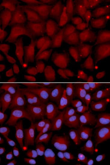 BCHE / Cholinesterase Antibody