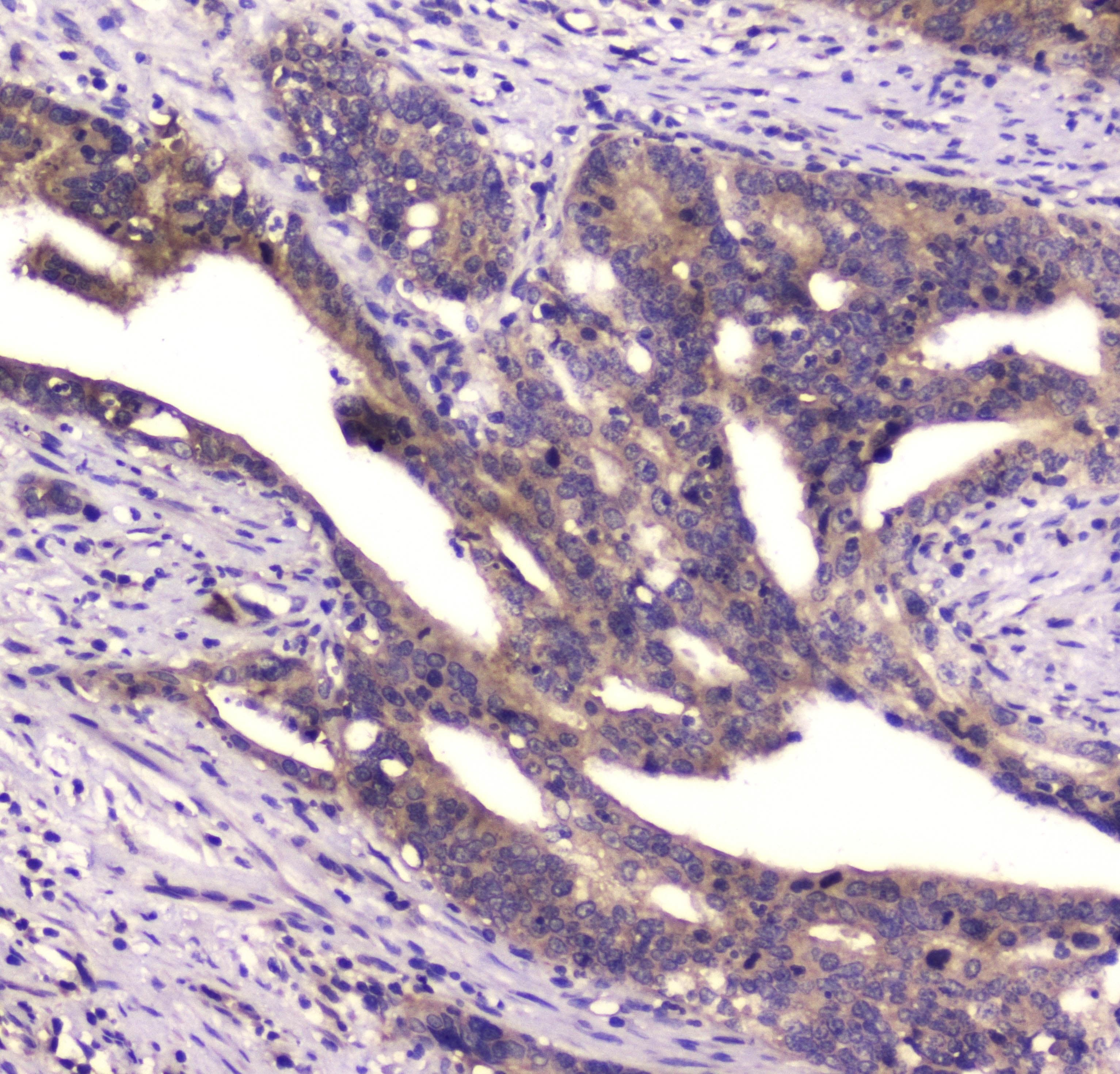 CD2AP Antibody