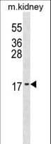 Polyclonal Rabbit anti-Human ID3 Antibody (aa10-37, WB)
