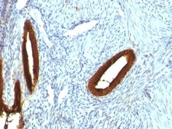 KRT19 / CK19 / Cytokeratin 19 Antibody (clone KRT19/800)