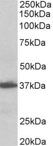 IHC-plus™ AIMP1 / EMAP II Antibody (aa137-149)